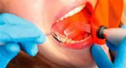 curso adhesión y composites para odontólogos
