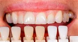 curso online adhesión y composites para odontólogos