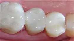 ##IMAGE##