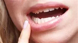 ##IMAGE##