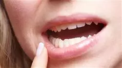 ##IMAGE##