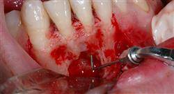 curso cirugía oral