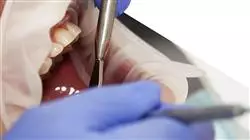posgrado protesis implante dental