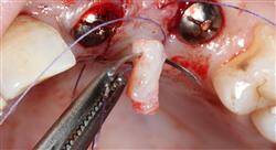 formacion periodoncia aplicada a la implantología