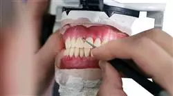##IMAGE##