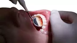 ##IMAGE##