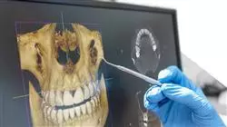 ##IMAGE##