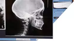 ##IMAGE##