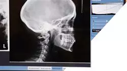 ##IMAGE##