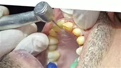 ##IMAGE##