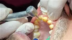 ##IMAGE##