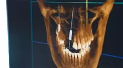 ##IMAGE##