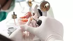##IMAGE##