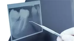 ##IMAGE##