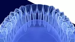 ##IMAGE##