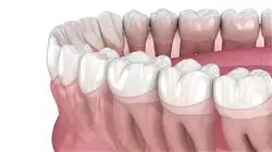 ##IMAGE##
