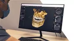 ##IMAGE##