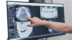 posgrado planificacion estetica odontologia