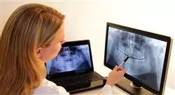 diplomado online excelencia en los procesos de la clínica dental