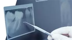 ##IMAGE##