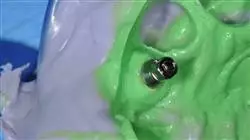 ##IMAGE##