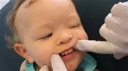 ##IMAGE##