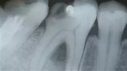 ##IMAGE##