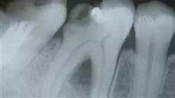 ##IMAGE##