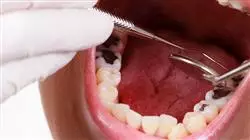 ##IMAGE##