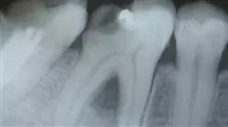 ##IMAGE##