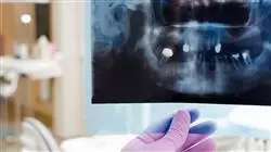 ##IMAGE##