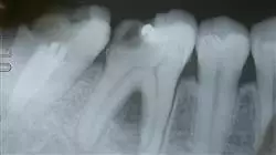 ##IMAGE##
