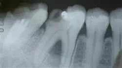 ##IMAGE##
