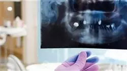 ##IMAGE##