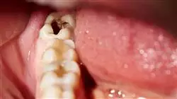 ##IMAGE##