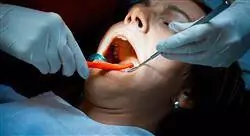 diplomado online problemas endodóncicos accidentes y complicaciones en endodoncia