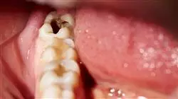 ##IMAGE##