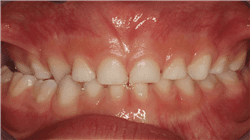 especializacion online patologia oral maxilofacial pediatrica