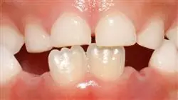 ##IMAGE##