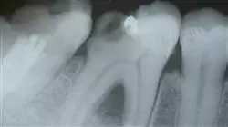 ##IMAGE##