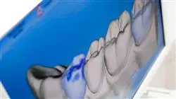 ##IMAGE##