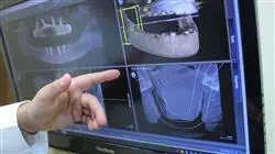 ##IMAGE##