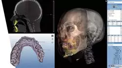 diplomado online aspectos eticos inteligencia artificial odontologia