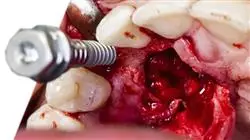 posgrado aspectos eticos inteligencia artificial odontologia