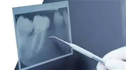##IMAGE##