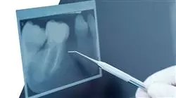 ##IMAGE##