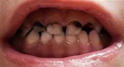 curso patología oral en odontología pediátrica