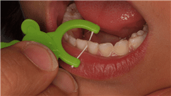 diplomado patologia oral odontologia pediatrica