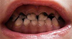 posgrado patología y terapéutica de la caries dental en odontopediatría