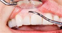 diplomado patología y terapéutica de la pulpa dental en odontopediatría